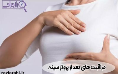 مراقبت های بعد از پروتز سینه صفر تا صد