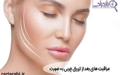 مراقبت های بعد از تزریق چربی به صورت + راهنمای کامل