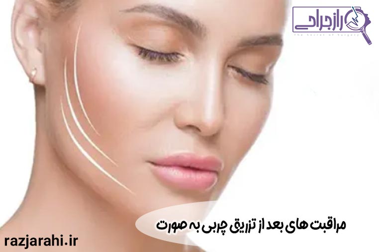 مراقبت های بعد از تزریق چربی به صورت