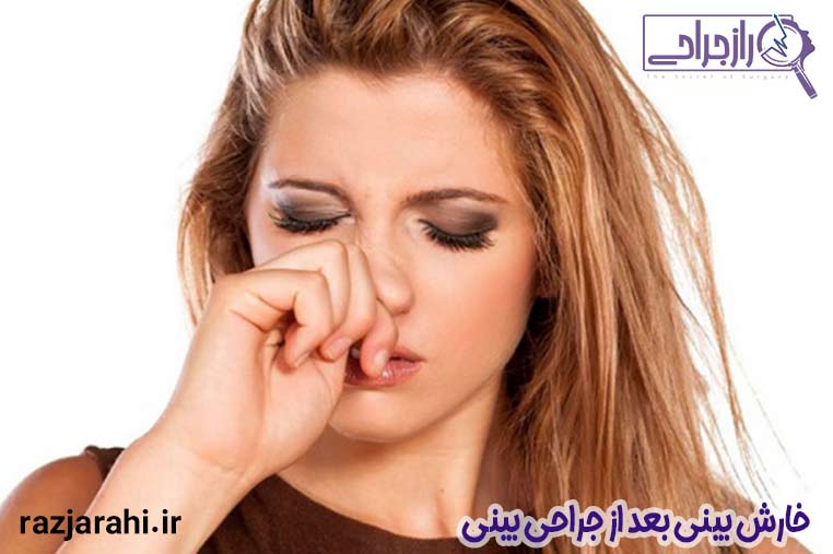 خارش بینی بعد از جراحی بینی