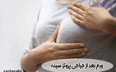 ورم بعد از جراحی پروتز سینه | علت و راههای کنترل آن