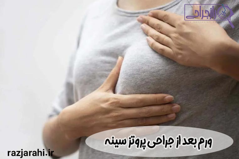 ورم بعد از جراحی پروتز سینه