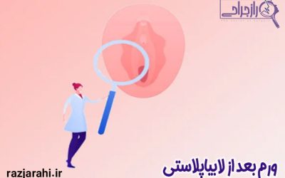 ورم بعد از لابیاپلاستی + نکات مهم