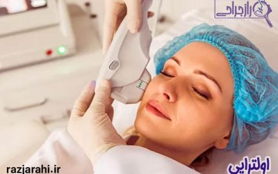 معجزه جوانی پوست با اولتراپی