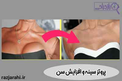 پروتز سینه و افزایش سن