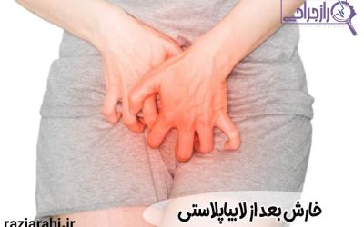 راه های درمان خارش بعد از لابیاپلاستی