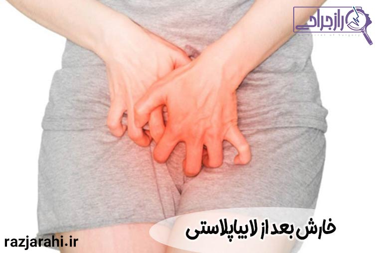 خارش بعد از لابیاپلاستی