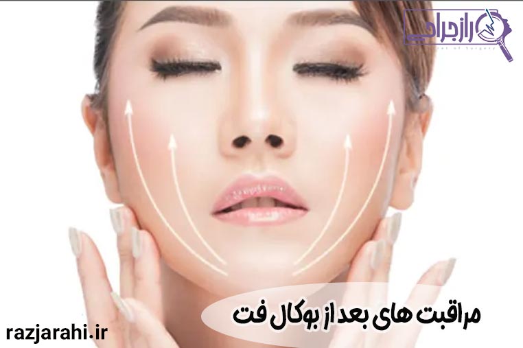 مراقبت های بعد از بوکال فت