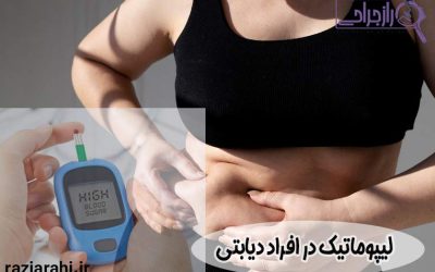 لیپوماتیک در افراد دیابتی