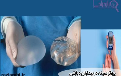 آیا پروتز سینه در بیماران دیابتی مجاز است؟
