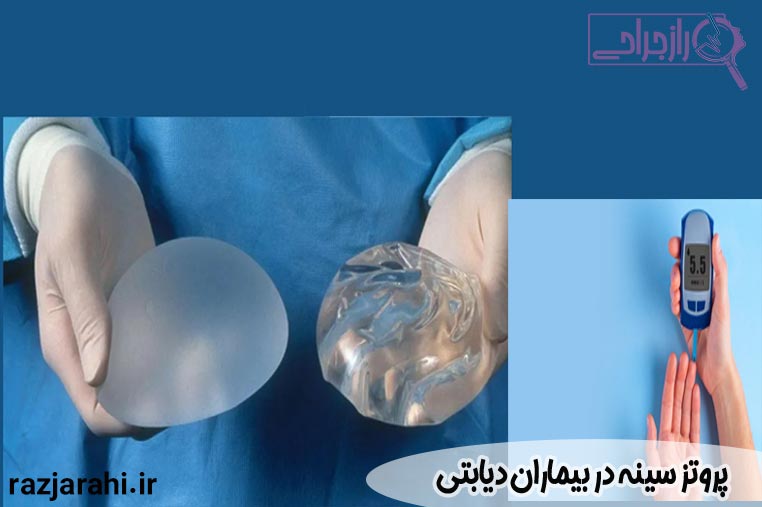 پروتز سینه در بیماران دیابتی
