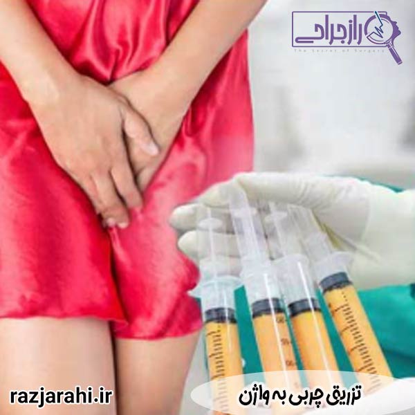 تزریق چربی به واژن