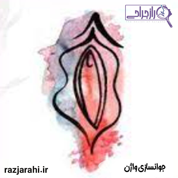 جوانسازی واژن