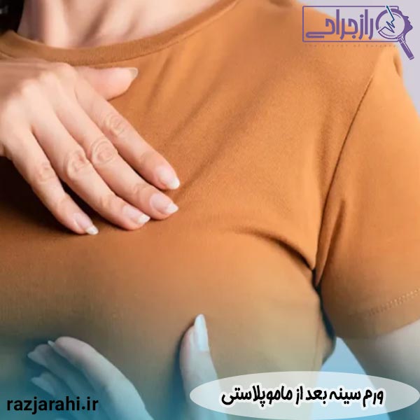 ورم سینه بعد از ماموپلاستی
