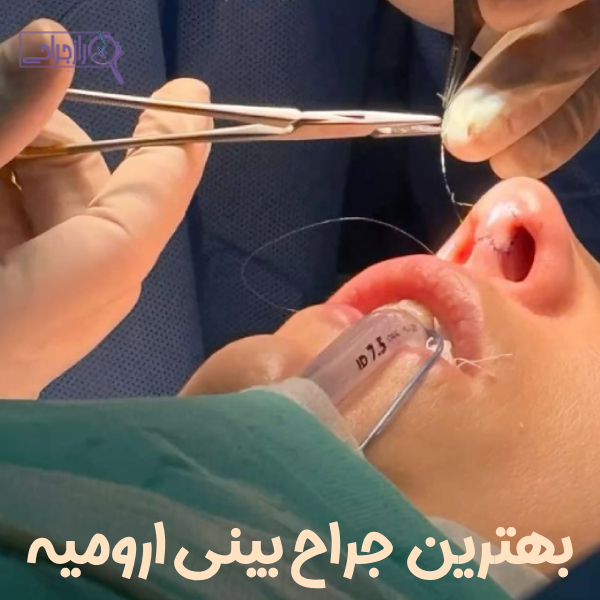 بهترین جراح بینی ارومیه